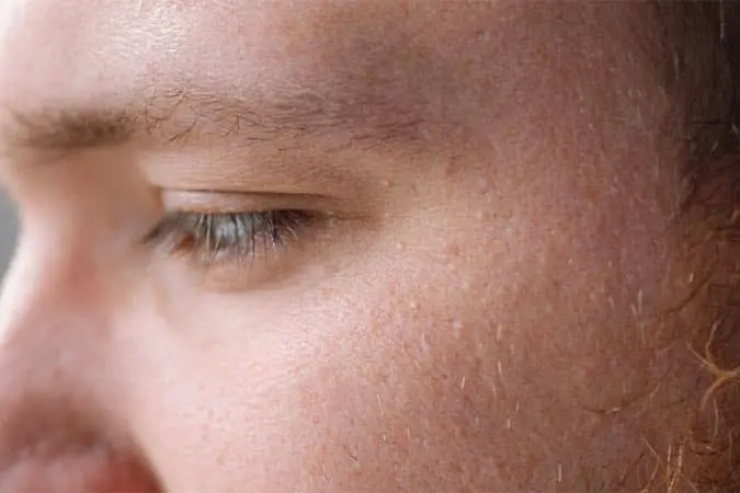 Bedford